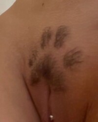 photo-thumb